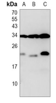 JTB Rabbit Polyclonal Antibody