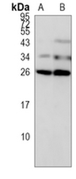 CIDEC Rabbit Polyclonal Antibody