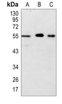ALK5 Rabbit Polyclonal Antibody