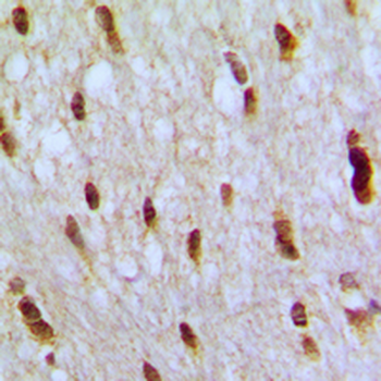 NFAT5 Rabbit Polyclonal Antibody