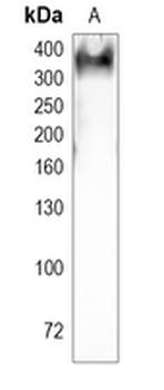Ki67 Rabbit Monoclonal Antibody