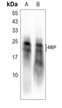 MBP Rabbit Monoclonal Antibody
