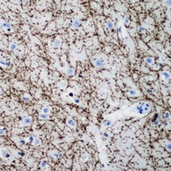 MBP Rabbit Monoclonal Antibody