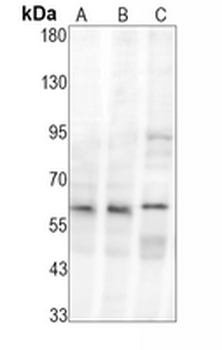 SMAD1 Rabbit Monoclonal Antibody