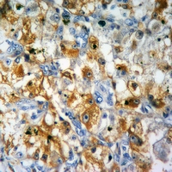 NLRP3 Rabbit Monoclonal Antibody