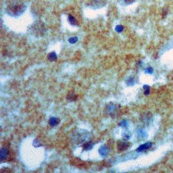Tyrosine Hydroxylase Rabbit Monoclonal Antibody