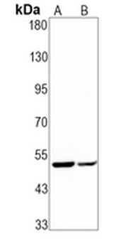 Vitronectin Rabbit Monoclonal Antibody