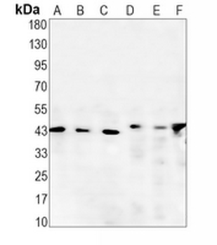 CDK9 Rabbit Monoclonal Antibody