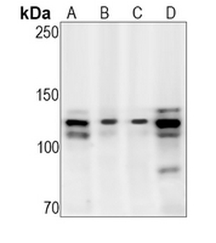 TAOK1/2/3 (Phospho-S181/S177) Rabbit Monoclonal Antibody