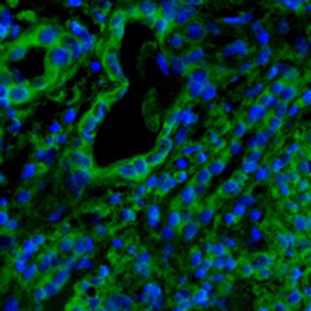 Cathepsin S Rabbit Monoclonal Antibody