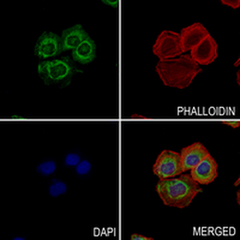 HSL (Phospho-S853) Rabbit Monoclonal Antibody