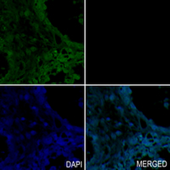 SMC1A (Phospho-S957) Rabbit Monoclonal Antibody