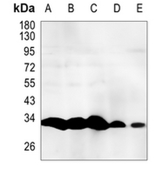 RPA2 (Phospho-T21) Rabbit Monoclonal Antibody