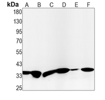 GNB2 Rabbit Monoclonal Antibody