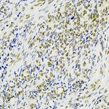 PB1 Rabbit Monoclonal Antibody