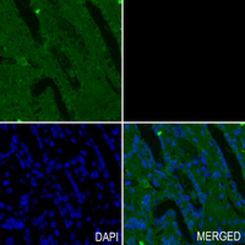 CD10 Rabbit Monoclonal Antibody