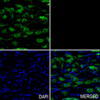 Aconitase 2 Rabbit Monoclonal Antibody