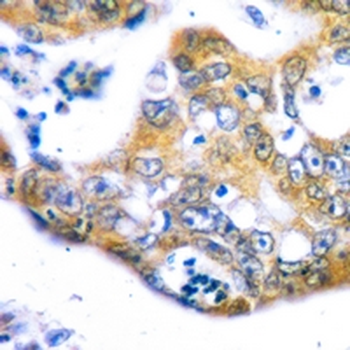 RACK1 Rabbit Monoclonal Antibody