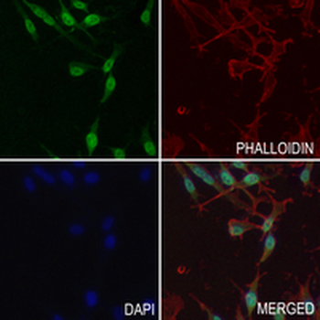 RACK1 Rabbit Monoclonal Antibody