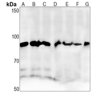 APPL1 Rabbit Monoclonal Antibody