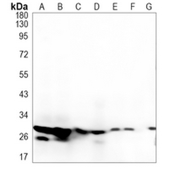 HIST1H1C Rabbit Monoclonal Antibody