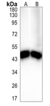 Na+/K+-ATPase beta1 Rabbit Monoclonal Antibody