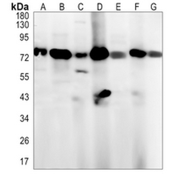 CD36 Rabbit Monoclonal Antibody