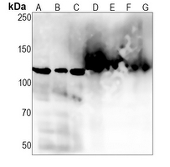 Matrin 3 Rabbit Monoclonal Antibody