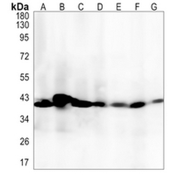 TMEM43 Rabbit Monoclonal Antibody