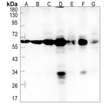PGM1 Rabbit Monoclonal Antibody