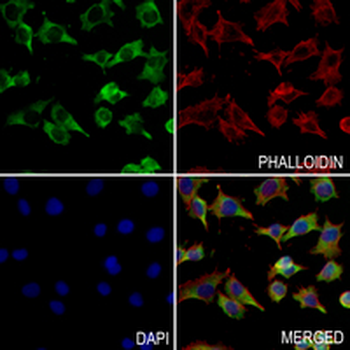 PGM1 Rabbit Monoclonal Antibody