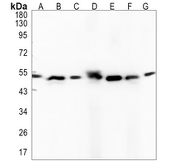 MST4 Rabbit Monoclonal Antibody