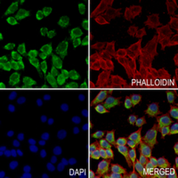 MST4 Rabbit Monoclonal Antibody