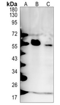 PFKFB3 Rabbit Monoclonal Antibody