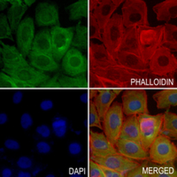 UQCRC2 Rabbit Monoclonal Antibody