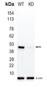 UQCRC2 Rabbit Monoclonal Antibody