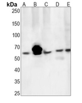 CD39 Rabbit Monoclonal Antibody