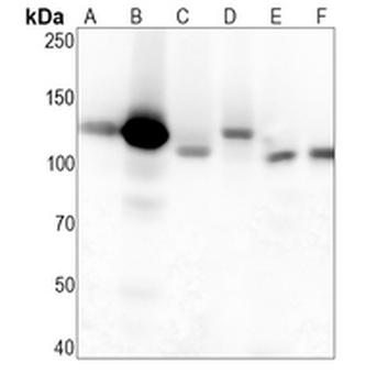 CD51 Rabbit Monoclonal Antibody