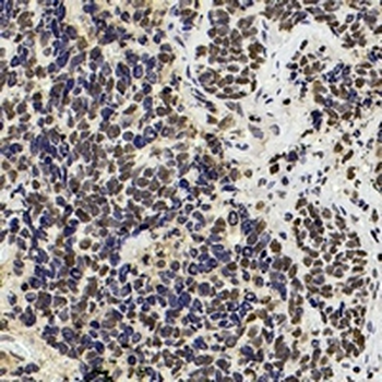 PARP1 Rabbit Monoclonal Antibody