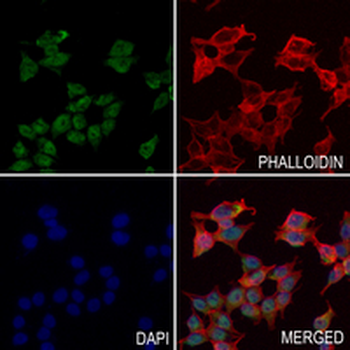 CHAT Rabbit Monoclonal Antibody
