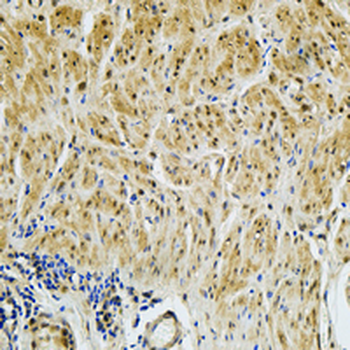 Ubiquitin (Linkage specific-K48) Rabbit Monoclonal Antibody