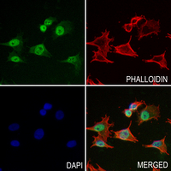Ubiquitin (Linkage specific-K48) Rabbit Monoclonal Antibody