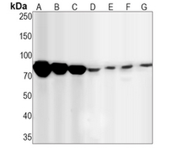 STAT1 Rabbit Monoclonal Antibody