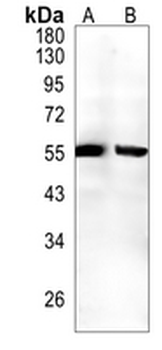 Caspase 8 Rabbit Monoclonal Antibody