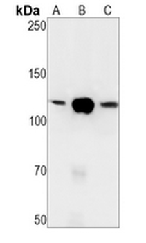 PARP1 Rabbit Monoclonal Antibody