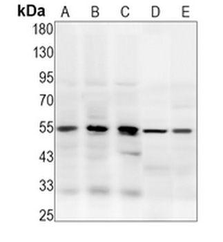 Caspase 8 Rabbit Monoclonal Antibody