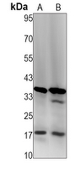 Caspase 3 Rabbit Monoclonal Antibody