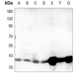 IKB alpha Rabbit Monoclonal Antibody