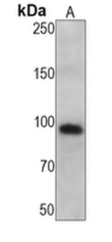 Complement C1S Rabbit Monoclonal Antibody