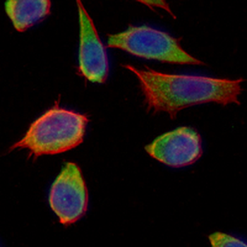 Axin-2 Rabbit Monoclonal Antibody